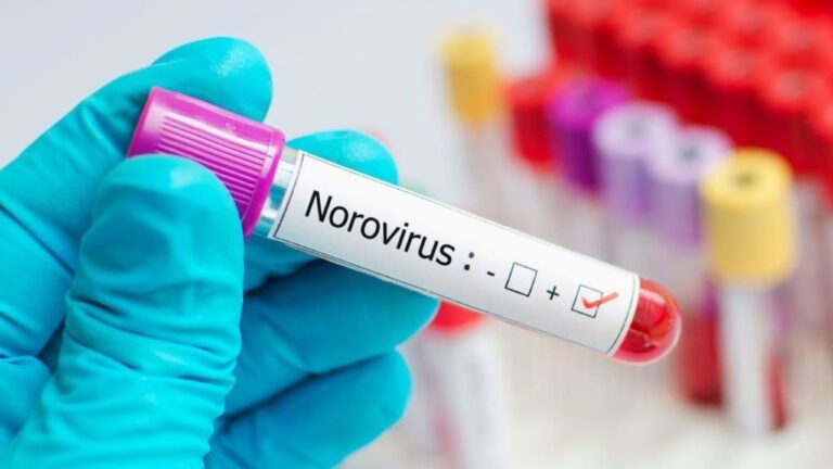 Norovirus outbreaks are being tracked this season, and your cleaning routine matters more than you think