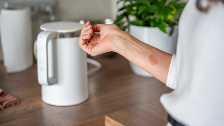 This kitchen appliance recall can burn you even if it “still works fine”