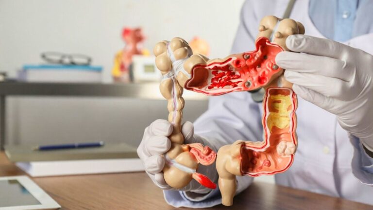 Colon cancer is hitting younger Americans harder — and Van Der Beek’s death is forcing the issue into the spotlight